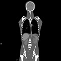 CT Torso Phantom CTU-41 2