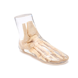 X-Ray Phantom Foot, transparent