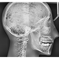 X-ray phantom head with cervical vertebrae, transparent 3