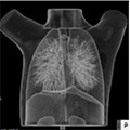 Pediatric Chest Phantom PH-1C 2